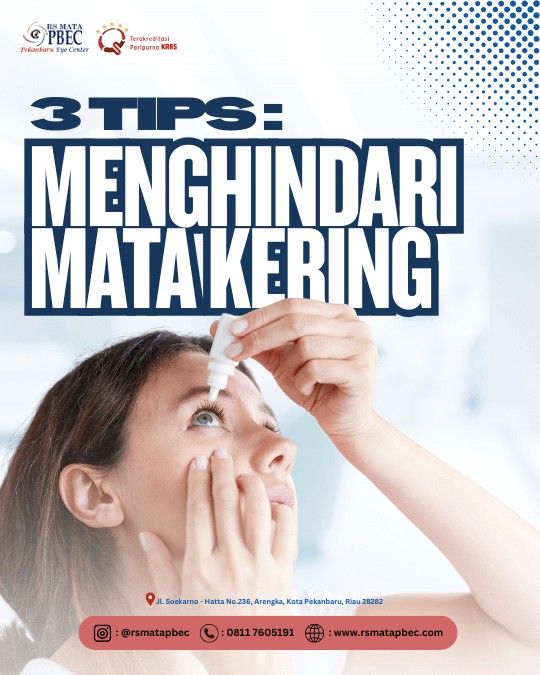 TIPS MENGHINDARI MATA KERING