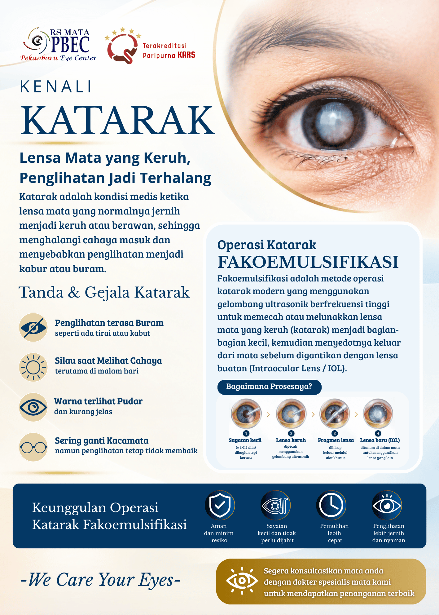 Kenali Katarak & Operasi Fakoemulsifikasi