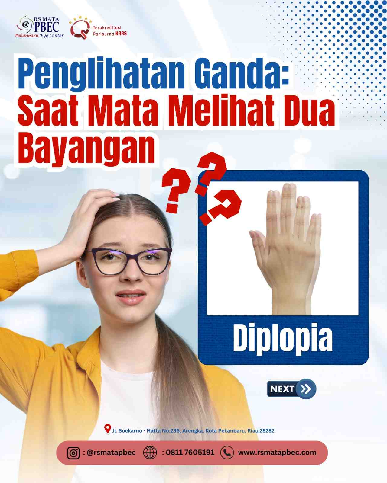 Diplopia Penglihatan Ganda: Saat Mata Melihat Dua Bayangan