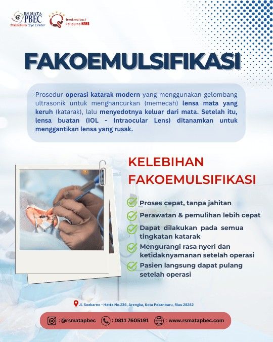 Operasi Katarak Tanpa Jahitan: Kenalan dengan Metode Fakoemulsifikasi