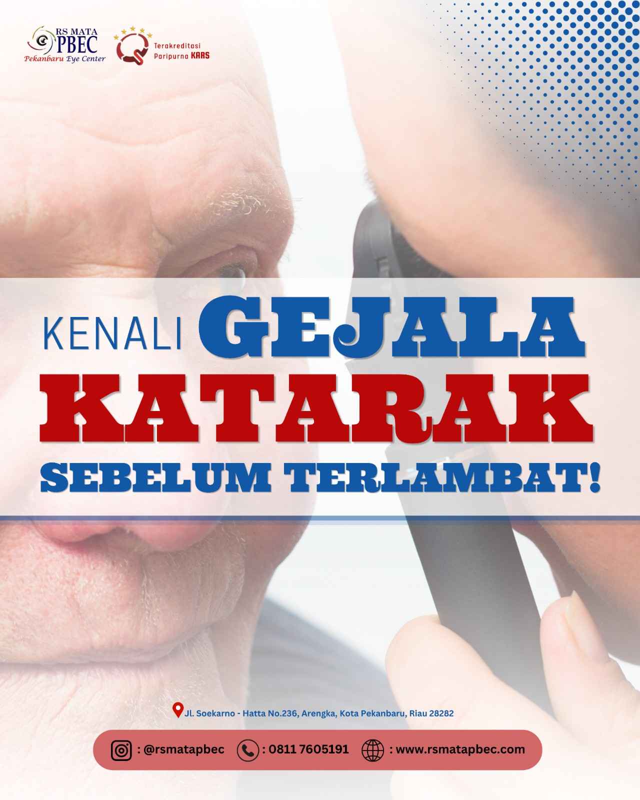 Kenali Gejala Katarak Sebelum Terlambat!
