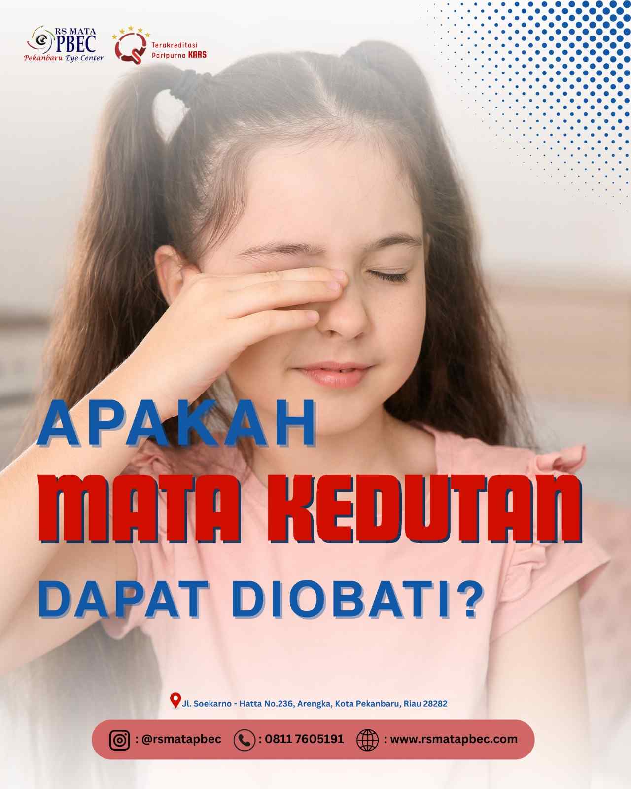 Apakah Mata Kedutan Dapat Diobati?