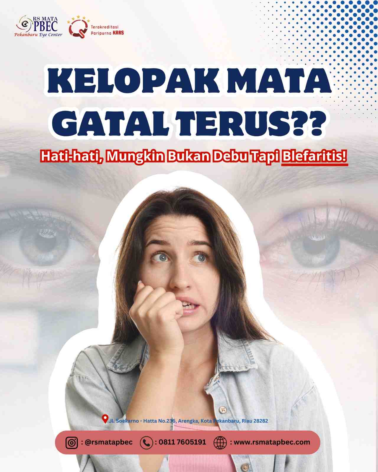Kelopak Mata Gatal Terus?? Hati-hati, Mungkin Bukan Debu Tapi Blefaritis!