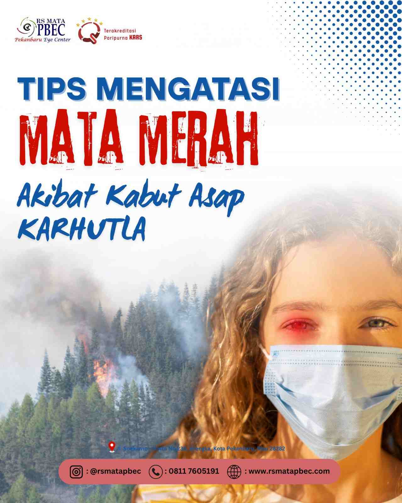 TIPS MENGATASI MATA MERAH  Akibat Kabut Asap Karhutla