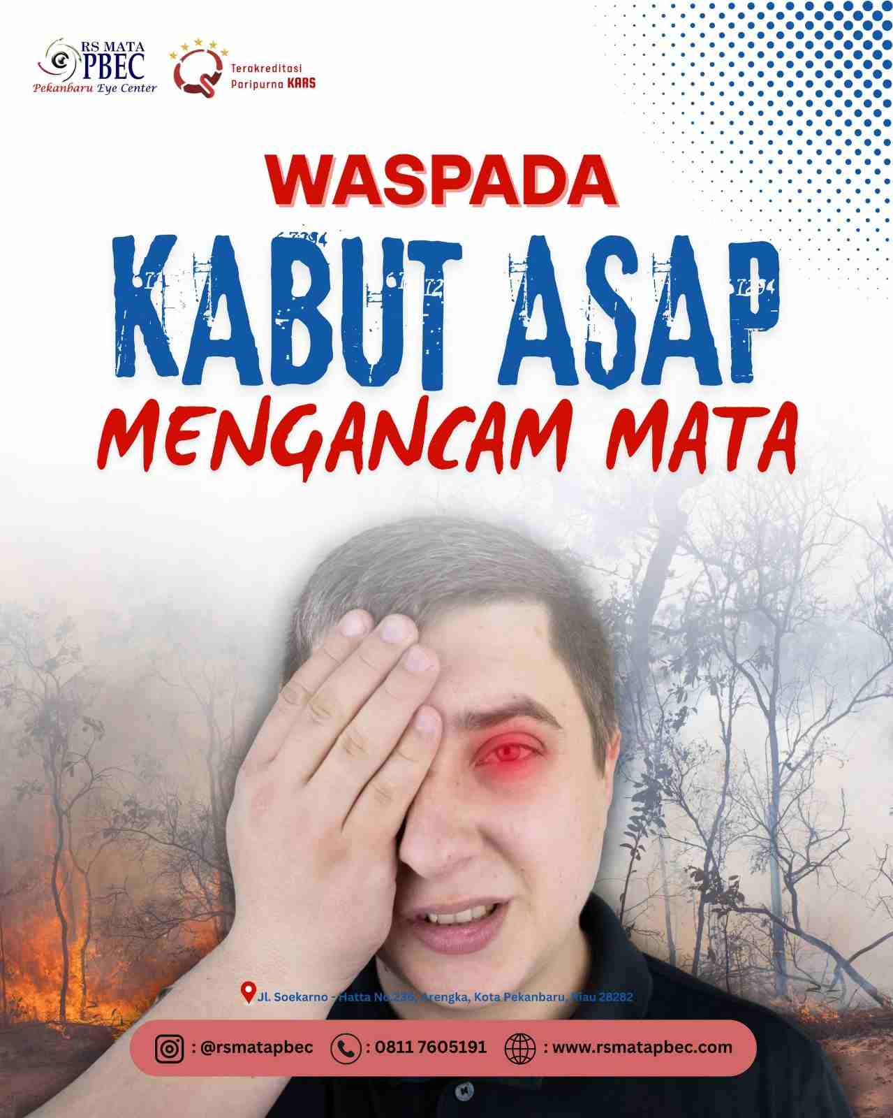 WASPADA KABUT ASAP MENGANCAM MATA