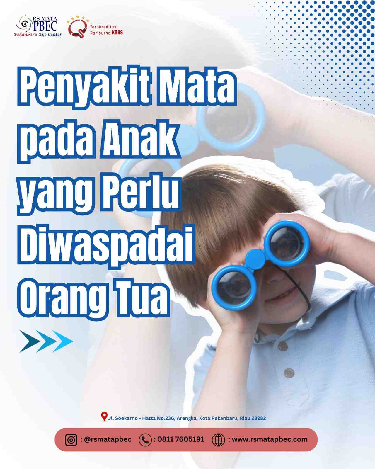 Penyakit Mata pada Anak yang Perlu Diwaspadai Orang Tua