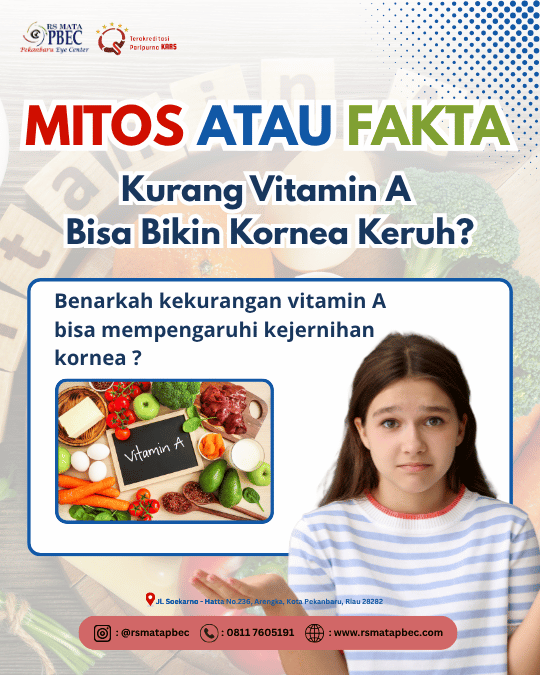MITOS ATAU FAKTA?Kekurangan Vitamin A Bisa Bikin Kornea Keruh? ????????️